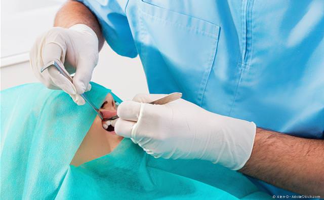 Sofortimplantation nach Zahnverlust innerhalb von 48 Stunden