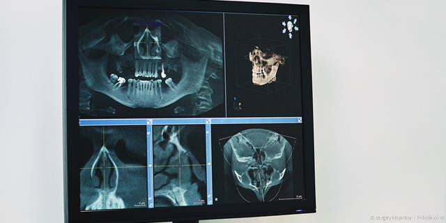 Digitale Volumentomographie (DVT): Dreidimensionale Kieferdarstellung